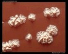 Mycobacterium fortuitum